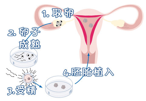 案例